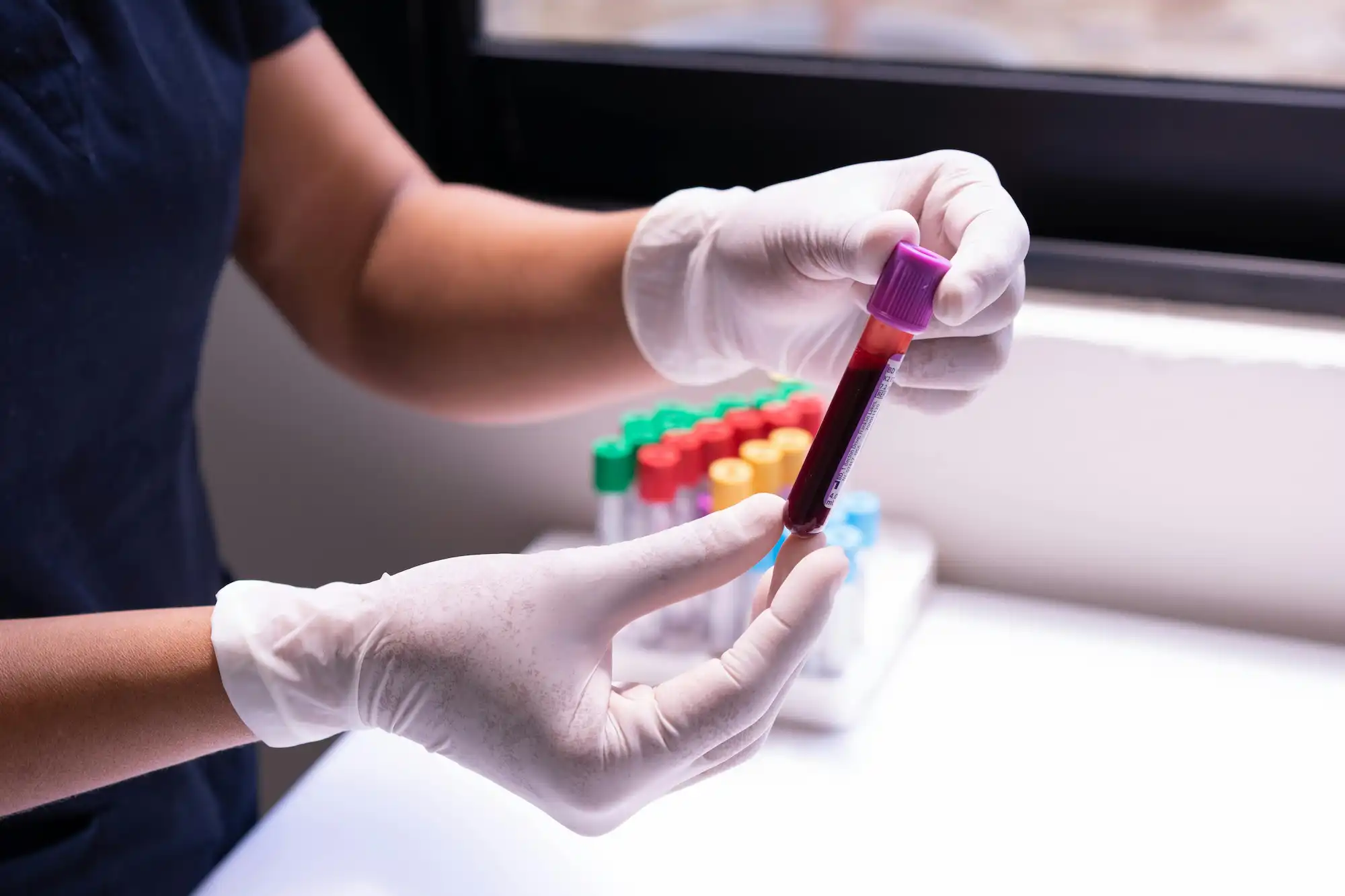 Milk & Blood Analysis
